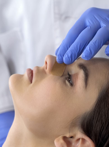 Acupunctur therapy